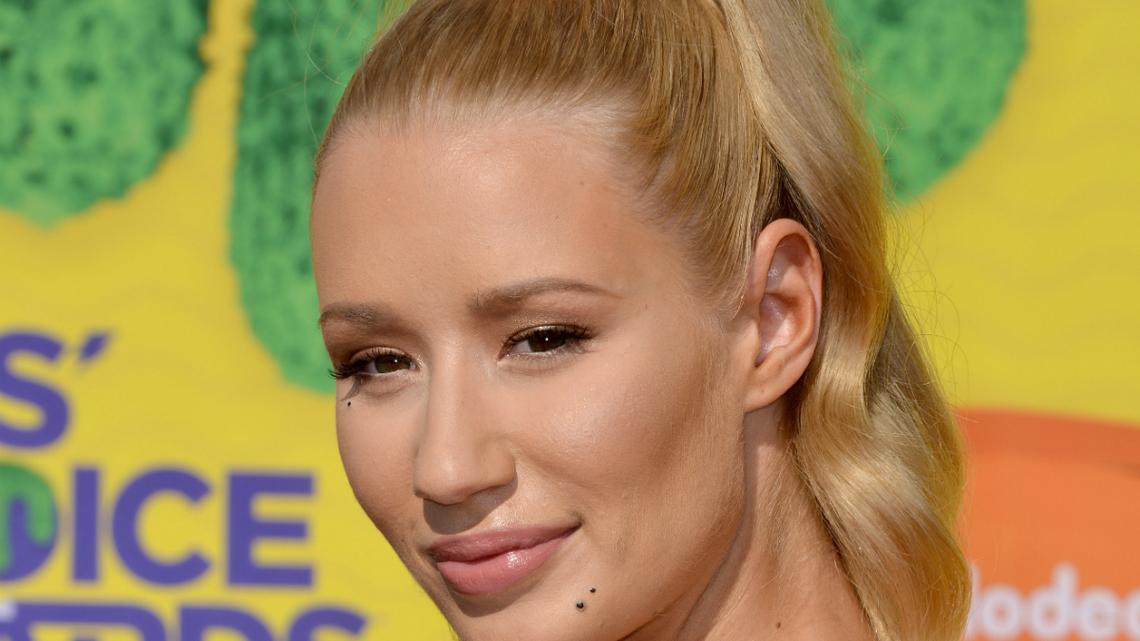 Iggy Azalea won't deny that she got a nose job – New York Daily News