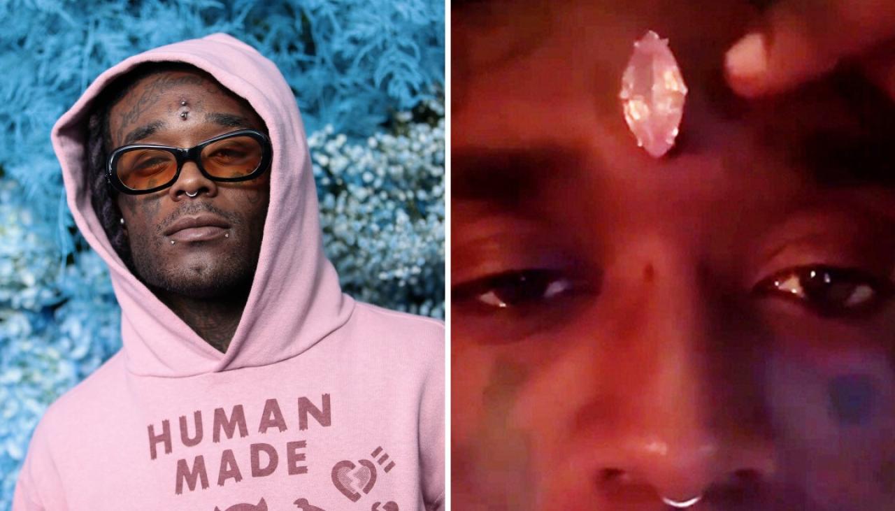 Lil Uzi Vert Says Million Diamond Forehead Implant Ripped Out By Fans At Rolling Loud