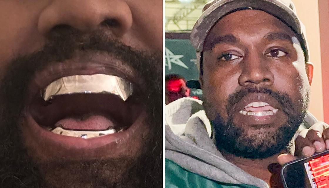 Kanye West seemingly replaces teeth with 'epic' 1.39m titanium