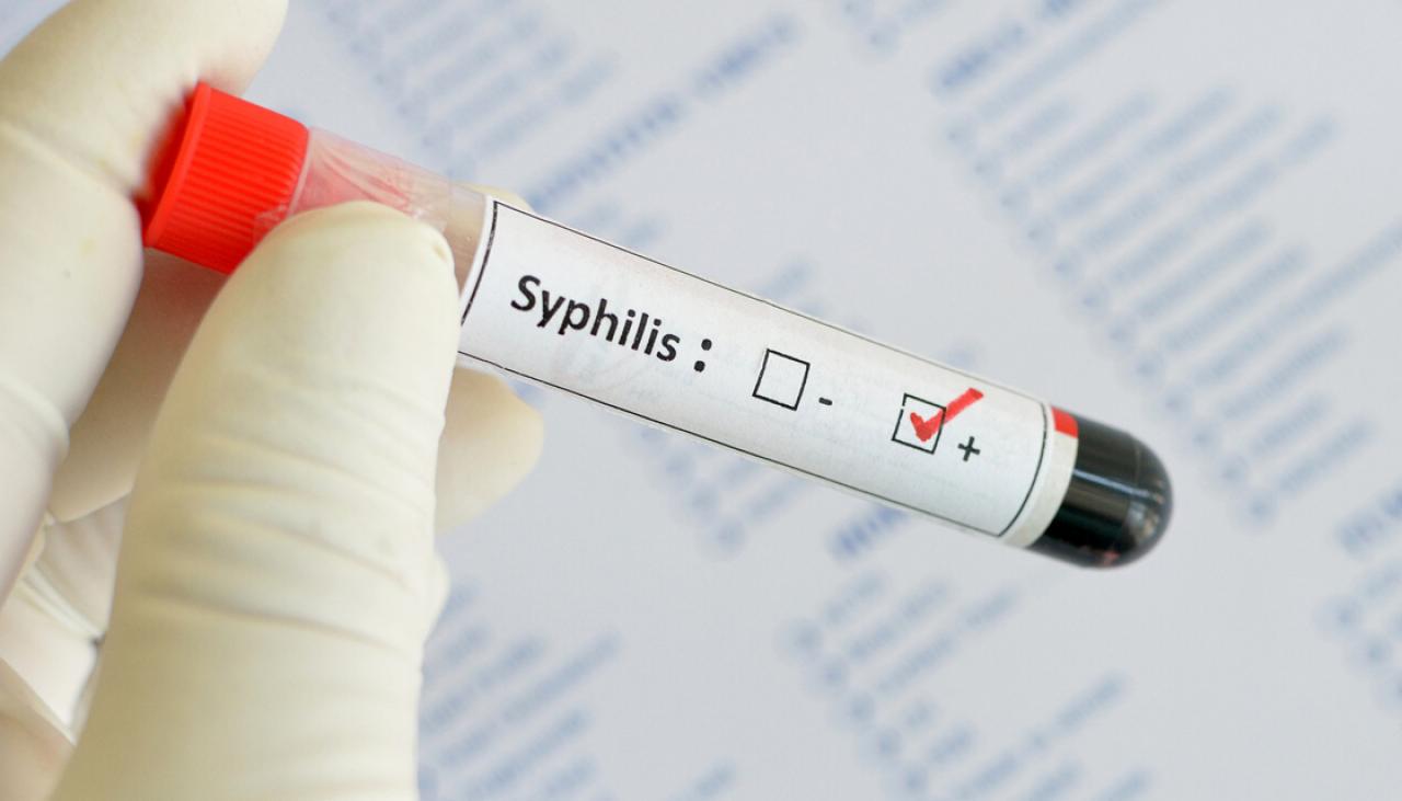 Syphilis Spreading In Auckland Could Hiv Be Next Newshub