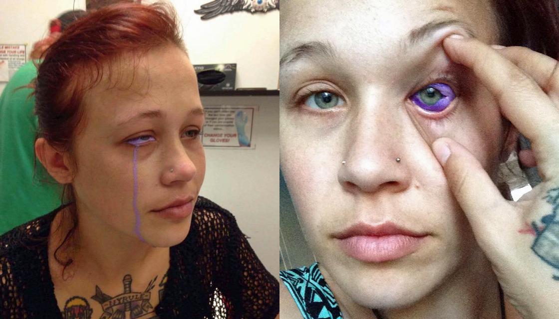 Woman May Have Eyeball Removed After Botched Eye Tattoo Newshub 0080