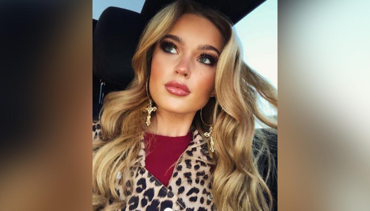 Model Warns Against Using Sunbeds After Horrific Experience Of Mole Removal Newshub