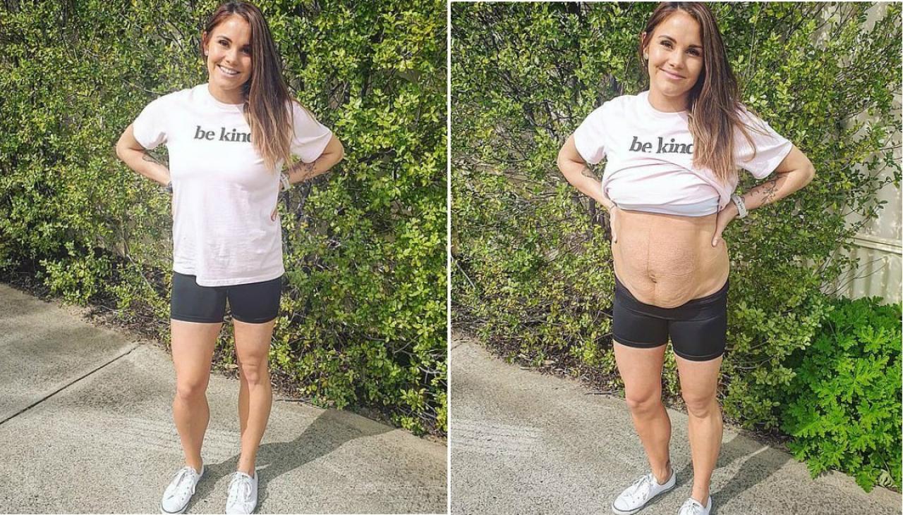 Aussie Mother Applauded For Showing Reality Of Postpartum Body After Having Quadruplets Newshub