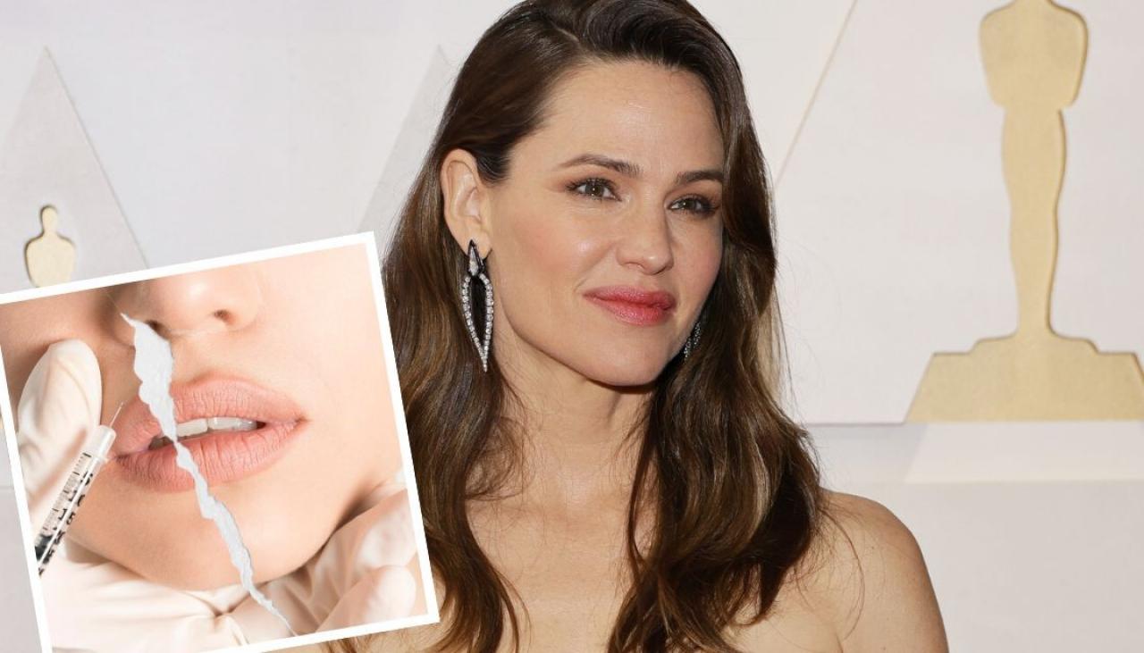 Jennifer Garner S Warning About The Risks Of Botox Filler And Injecting Anything Into Your