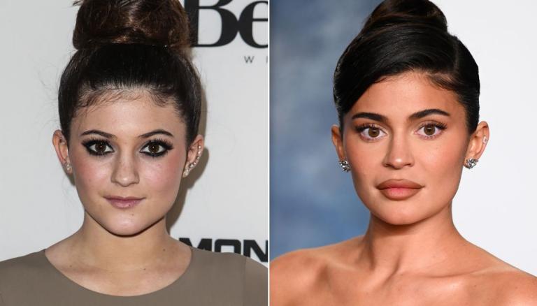 Kylie Jenner Backlash for Remarks on Plastic Surgery, Beauty Standards