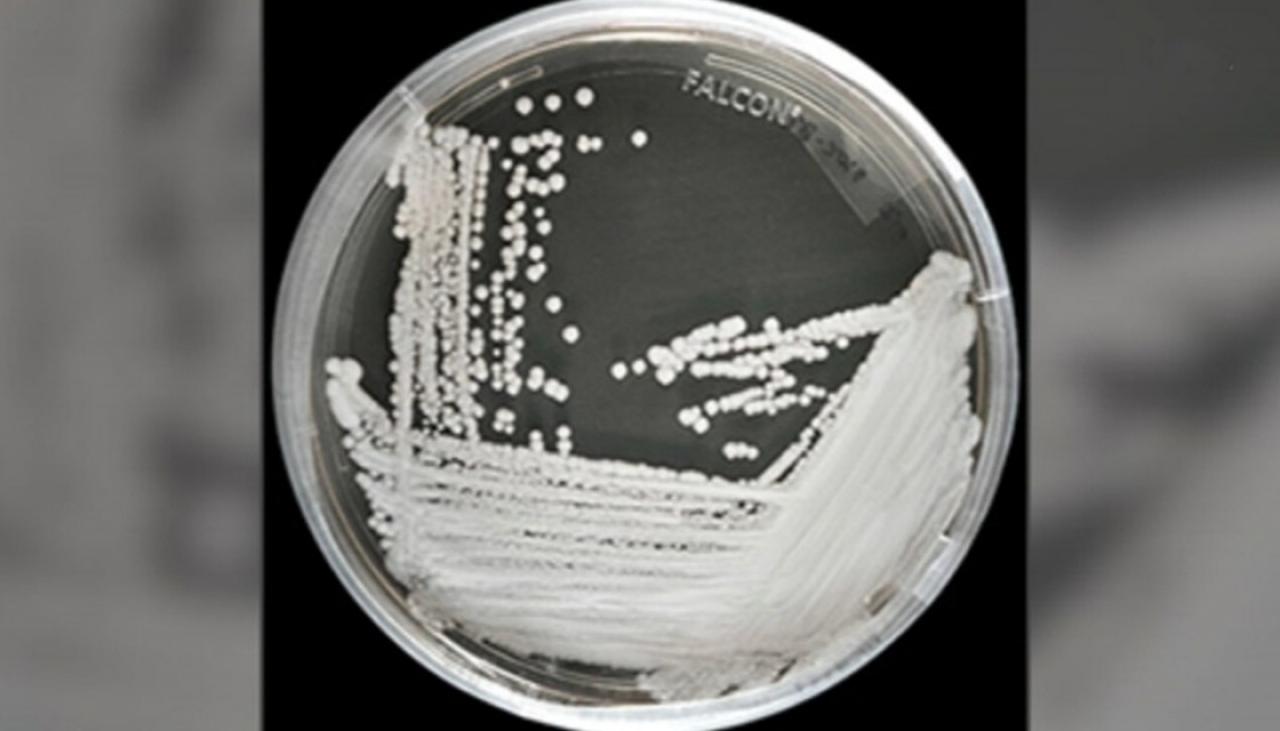 Deadly Super Fungus Candida Auris Detected In New Zealand Newshub