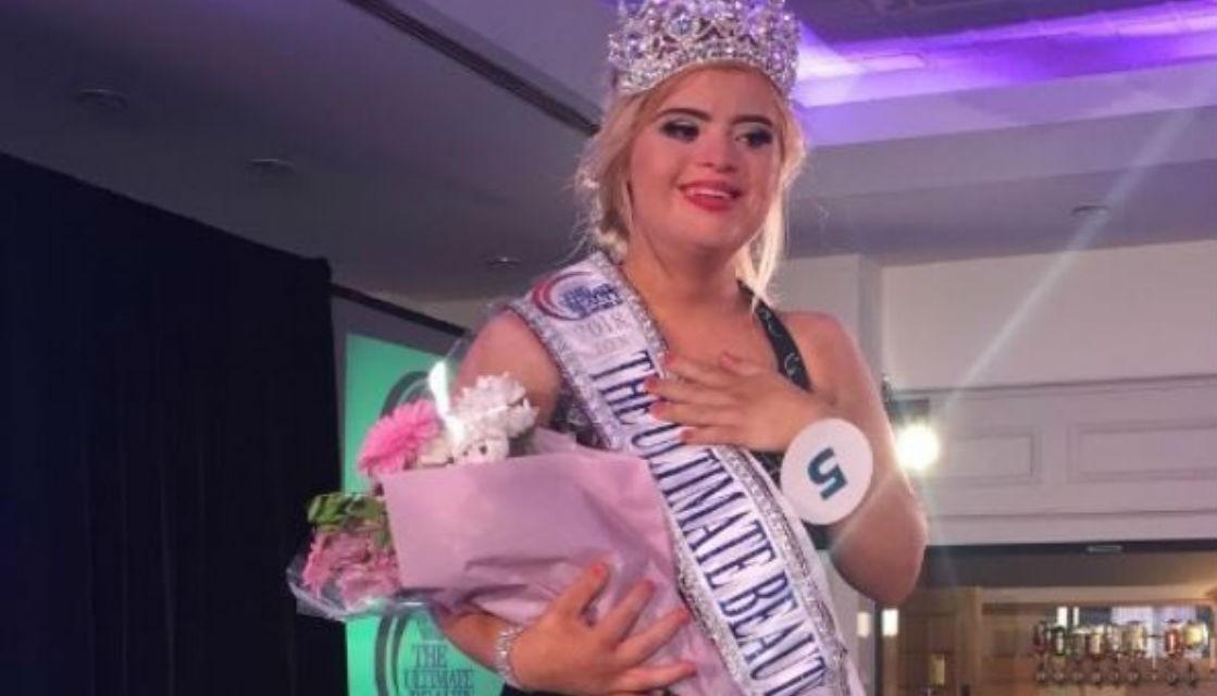 Model With Down Syndrome Wins International Beauty Pageant Newshub 