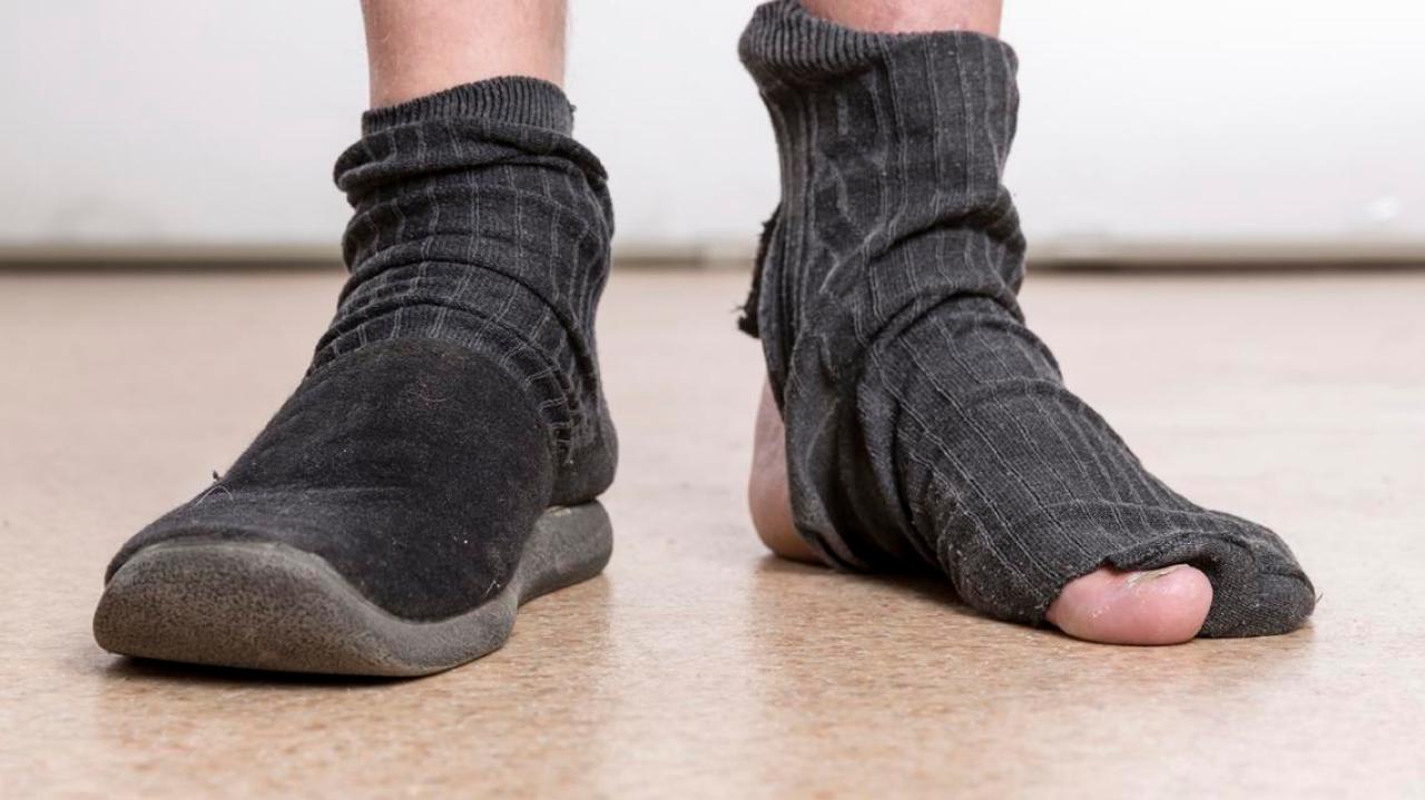 Man Addicted To Sniffing His Socks Hospitalised With Severe Fungal Lung